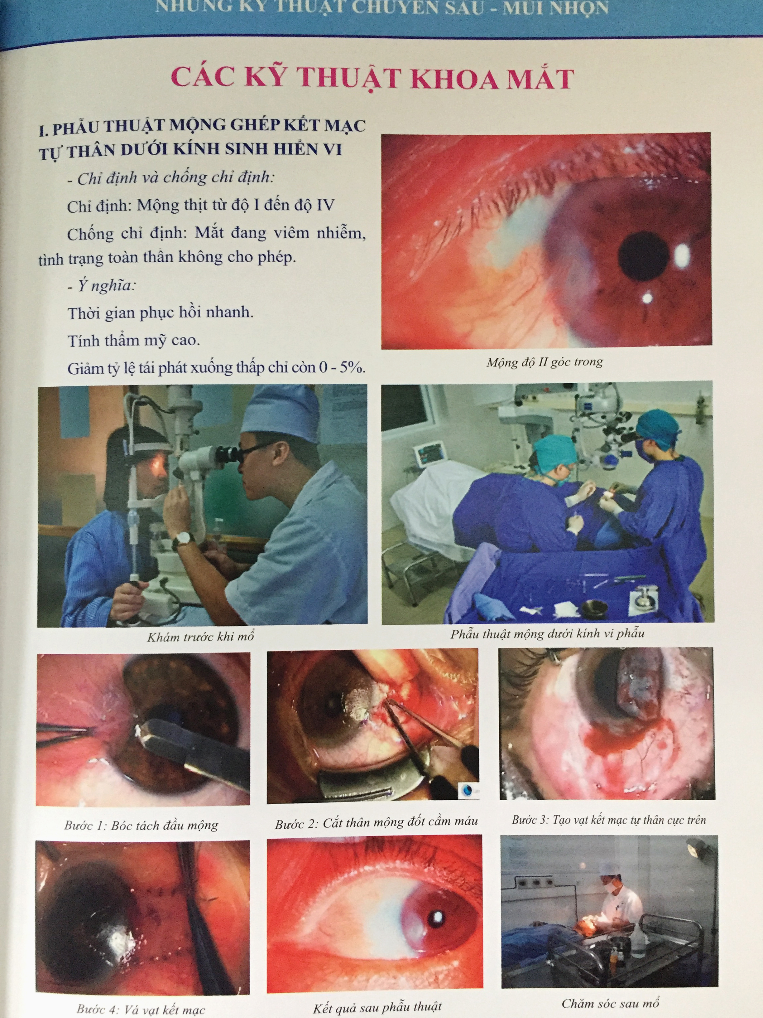 Phẫu thuật chuyên khoa mắt 1