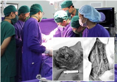 Bệnh nhân vượt ngàn cây số đến Quảng Ninh phẫu thuật ung thư